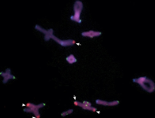 rDNA